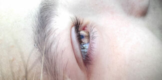Objawy jęczmienia na oku oraz jak go leczyć